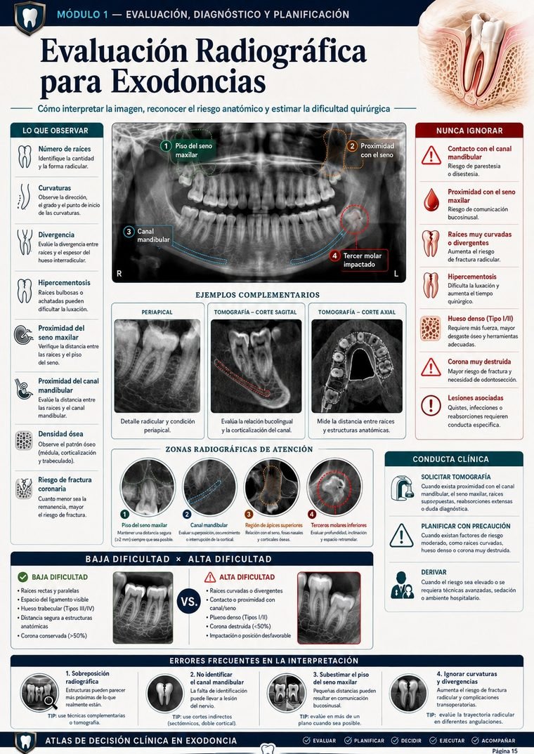 Evaluación Radiográfica para Exodoncias