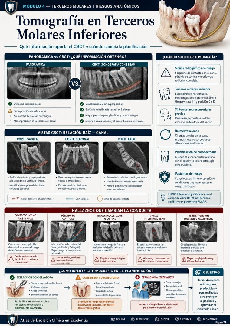 Tomografía en Terceros Molares Inferiores